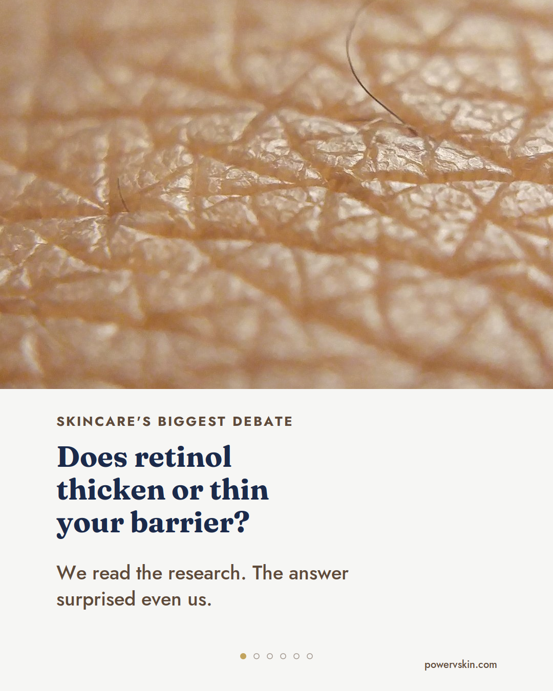 Does Retinol Thicken or Thin Your Skin Barrier?